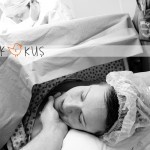 epidural-sezaryen
